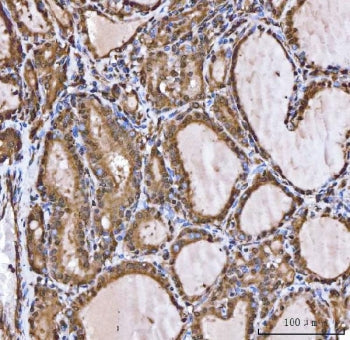 XAF1 Antibody / XIAP associated factor 1