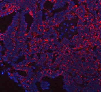 PRDM15 Antibody / PR/SET domain 15