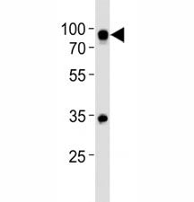 Western blot analysis of lysate from Ramos cell line using CD19 antibody at 1:500. Expected size is