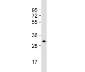 IGFBP5 Antibody / IGF binding protein 5