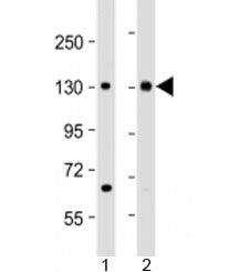 MTUS1 Antibody / Microtubule-associated tumor suppressor 1