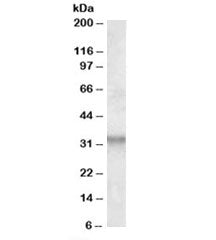 Western blot testing of human hippocampus lysate with ITM2B antibody at 1ug/ml. Predicted molecular