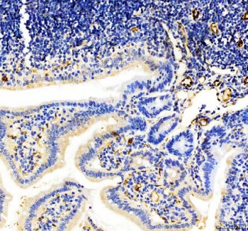 CD31 Antibody / PECAM-1