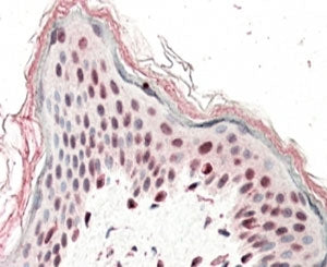 SRCAP Antibody