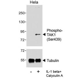 Phospho-TAK1 Antibody (Ser439)