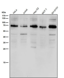 Western blot testing of human samples using the ACBD3 antibody at 1:1000 dilution for 1 hour at room temperature. A single major band is detected just below the 70 kDa marker, consistent with the expected migration of full-length ACBD3, which typically runs above its predicted 61 kDa mass due to phosphorylation and the structured coiled-coil/GOLD domains that alter SDS–PAGE mobility. The observed band therefore represents the mature, Golgi-associated form of ACBD3.