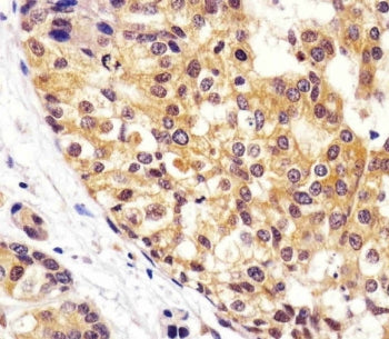 VCP Antibody