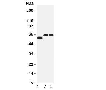 Western blot testing of SLC1A4 antibody and Lane 1: human U87; 2: rat brain; 3: mouse brain tissue l