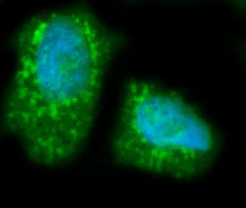 LIPC Antibody / Hepatic Lipase