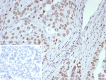 ARID1A Antibody