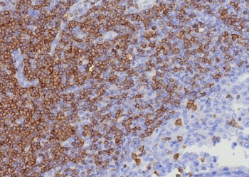 IHC staining of FFPE human lymph node tissue with CD7 antibody (clone CD7/8357R). h HIER: boil tissu