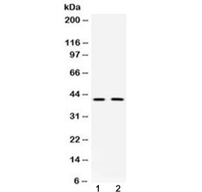 Doublecortin Antibody / DBCN / DCX