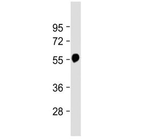 Beta Tubulin Antibody / TUBB
