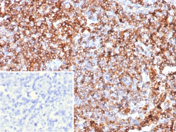 IHC staining of FFPE human lymph node tissue with Guanylate binding protein 1 antibody (clone GBP1/7