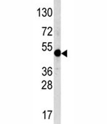 AP2 alpha Antibody (TFAP2A)