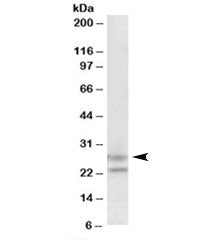 FBXO44 Antibody