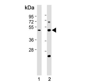 Western blot testing of 1) human kidney and 2) mouse kidney tissue lysate with Galactosylceramide su