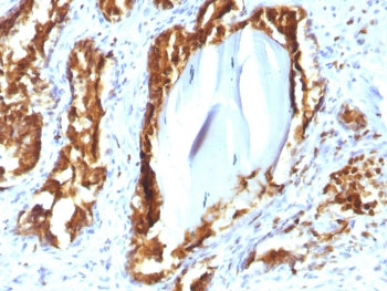 PSAP Antibody / Prostate Specific Acid Phosphatase