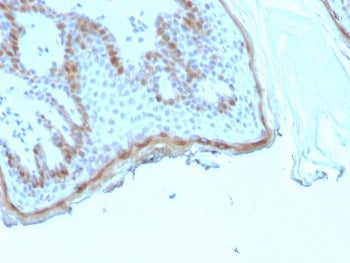 IHC staining of FFPE human skin tissue with recombinant FLG antibody (clone rFLG/1945). HIER: boil t