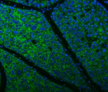 Citrin Antibody / ARALAR2 / SLC25A13