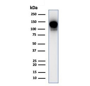 PI3KCD Antibody / PI3K delta / p110delta