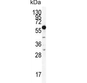 HDAC2 Antibody