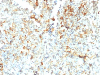 FCGRT Antibody