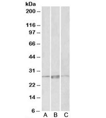 Western blot testing of human heart lysate with PRRX1 antibody at 1ug/ml. Predicted molecular weight