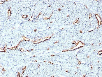 IHC staining of FFPE human uterus tissue with CD31 antibody (clone C31/8359R). HIER: boil tissue sec