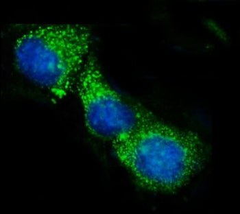 Immunofluorescent staining of FFPE human MCF7 cells with ACADS antibody (green) and DAPI nuclear sta