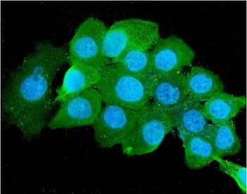 Beta-2 Microglobulin Antibody