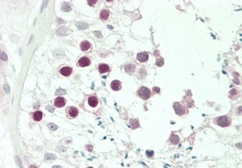 JHDM1D Antibody / KDM7A
