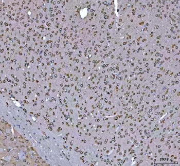 IHC staining of FFPE mouse brain tissue with GRP78 antibody. HIER: boil tissue sections in pH8 EDTA