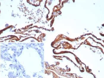 Periostin Antibody