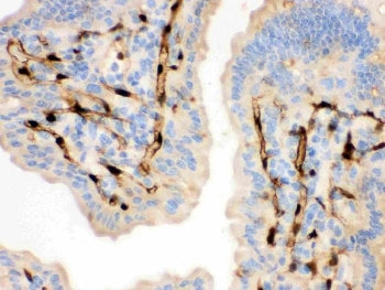 FABP4 Antibody