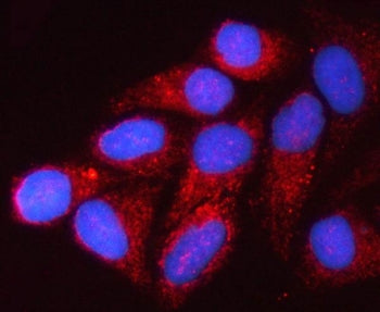 VDAC1 Antibody