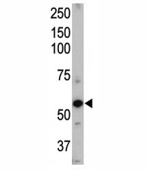 ALK1 Antibody