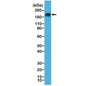 CEA Antibody / Carcinoembryonic Antigen