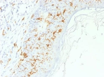 CD1a Antibody