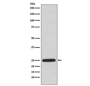 HPRT Antibody