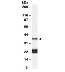 GALR1 Antibody