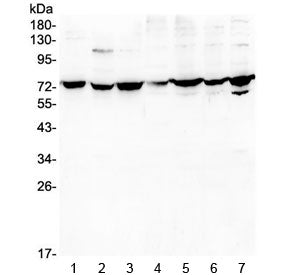 DARS2 Antibody