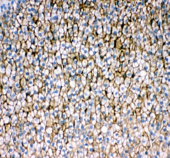 Srb1 Antibody