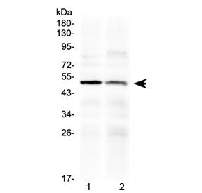 Western blot testing of human 1) PANC1 and 2) HepG2 cell lysate with HtrA3 antibody at 0.5ug/ml. Pre