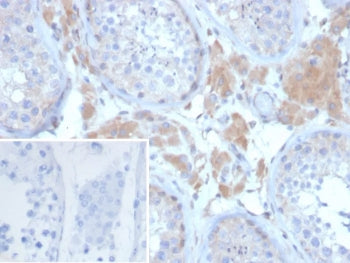 IHC staining of FFPE human ovary tissue with Growth Differentiation Factor 9 antibody (clone GDF9/64