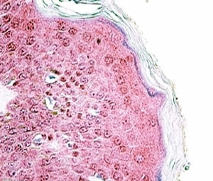 TRIM29 Antibody