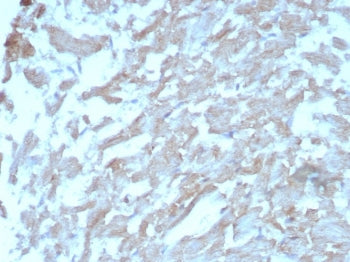 FABP3 Antibody