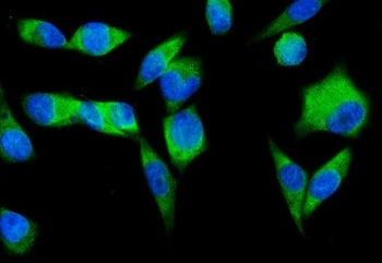 SND1 Antibody / TDRD11