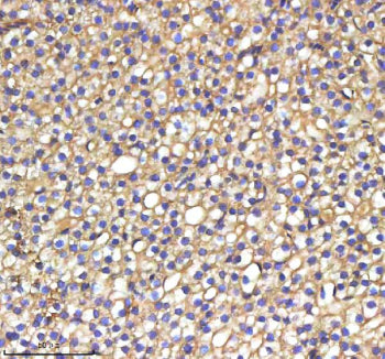 IHC staining of zebrafish Srebf1 protein using Zebrafish Srebf1 antibody, HRP-labeled secondary and