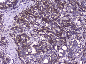 Capicua Antibody / CIC